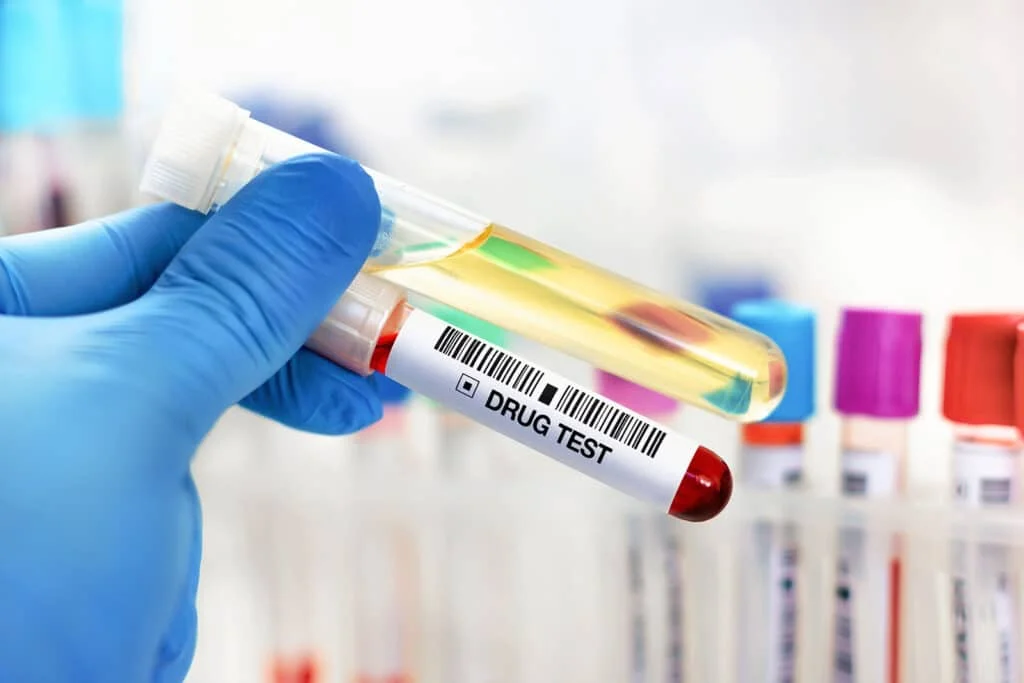 Poți refuza un test antidrog la locul de muncă și care sunt consecințele?